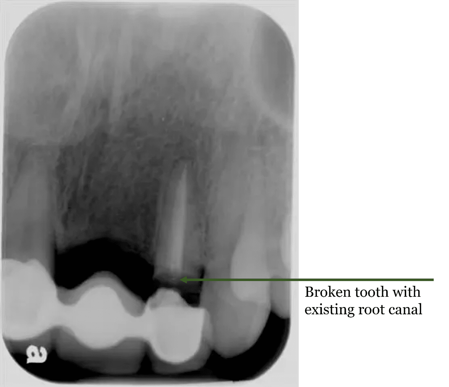 X-ray Example